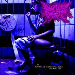 Emaciated Waste : In Advanced Hemorrhoiding Conditions